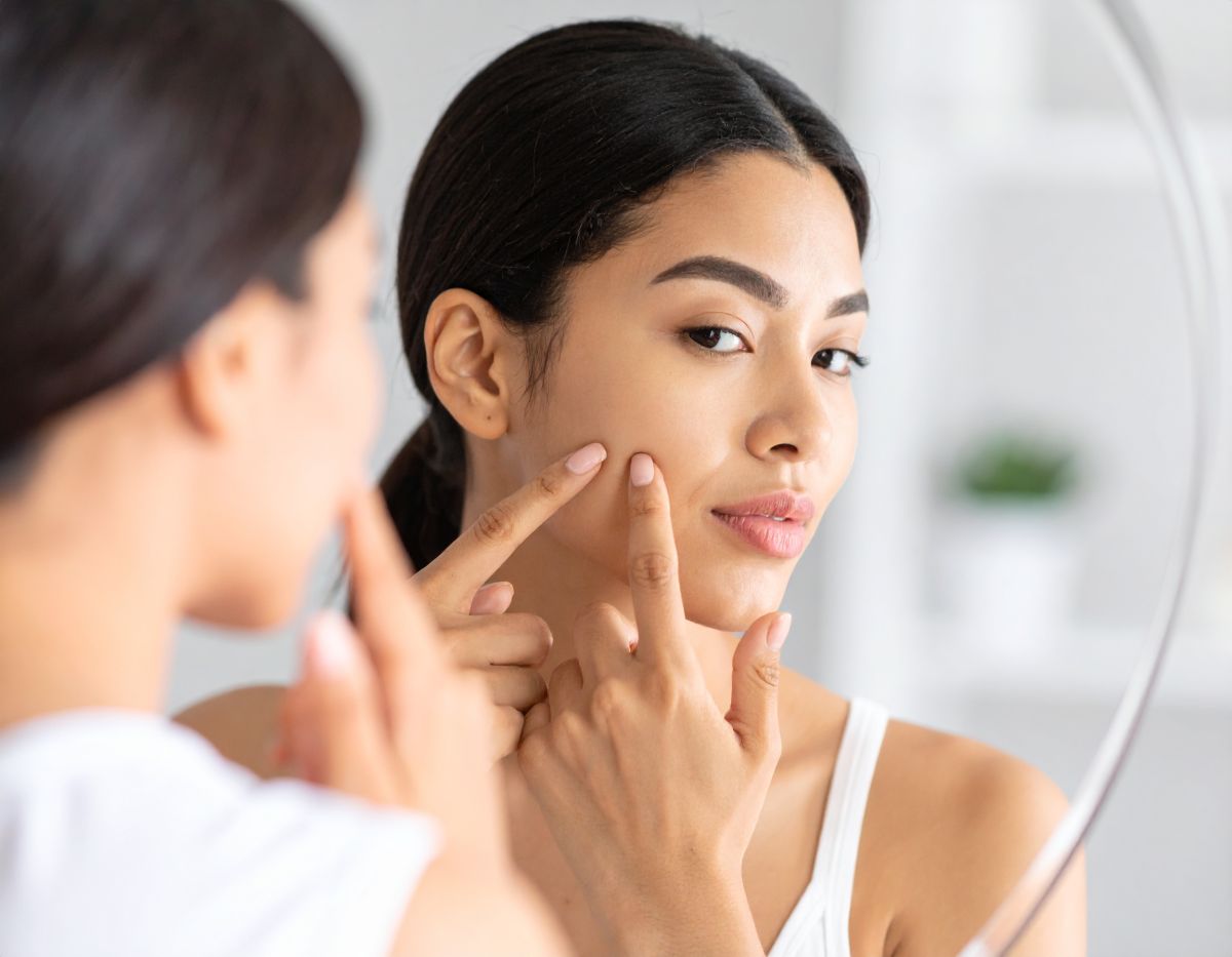 L’acné adulte : comment y faire face efficacement ?